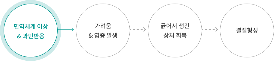 결정성양진이 발생하는 과정